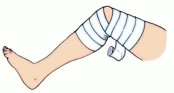 Bandage élastique